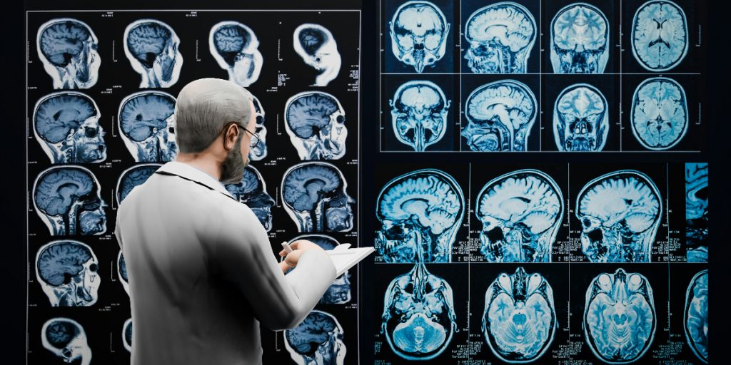 A Neuroscientist’s Bold Proposal for Solving Brain Disorders